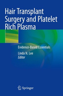 Hair Transplant Surgery and Platelet Rich Plasma