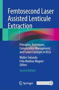 Femtosecond Laser Assisted Lenticule Extraction