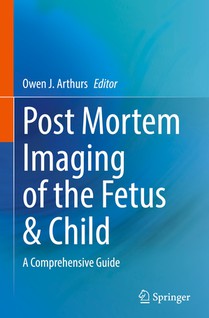 Post Mortem Imaging of the Fetus & Child