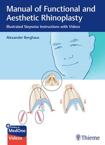 Manual of Functional and Aesthetic Rhinoplasty