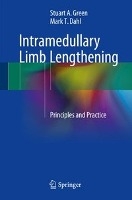 Intramedullary Limb Lengthening