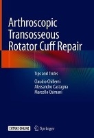 Arthroscopic Transosseous Rotator Cuff Repair
