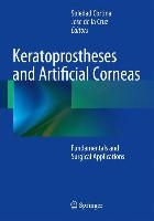 Keratoprostheses and Artificial Corneas
