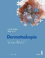 Dermatoskopie