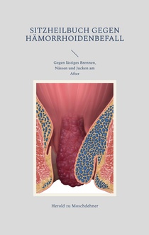 Sitzheilbuch gegen Hämorrhoidenbefall