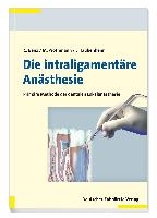 Die intraligamentäre Anästhesie