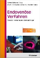 Endovenöse Verfahren