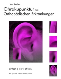Ohrakupunktur bei Orthopadischen Erkrankungen