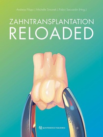 Zahntransplantation Reloaded