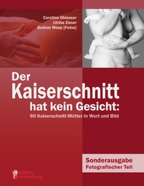 Der Kaiserschnitt hat kein Gesicht
