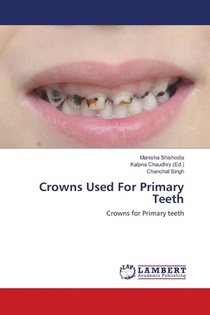 Crowns Used For Primary Teeth