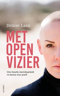 Met open vizier