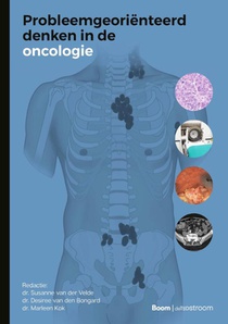 Probleemgeoriënteerd denken in de oncologie