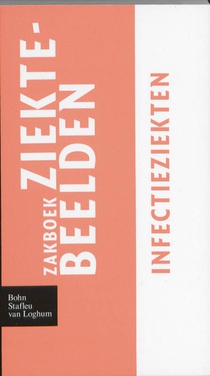 Infectieziekten