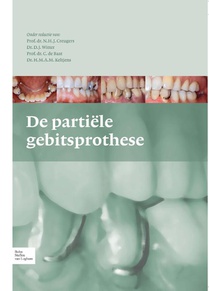 De partiele gebitsprothese