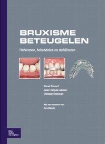 Bruxisme beteugelen