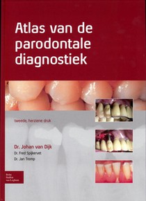 Atlas van de parodontale diagnostiek voorzijde