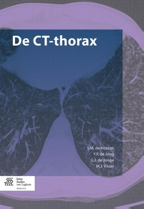 De CT-thorax voorzijde