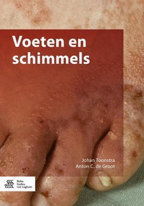 Voeten en schimmels voorzijde