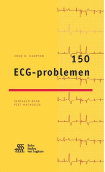 150 ECG-problemen