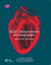 ECG's - beoordelen én begrijpen voorzijde