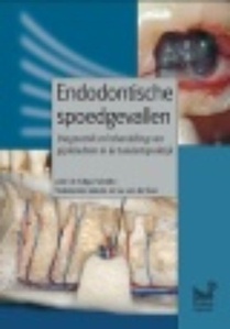 Endodontische spoedgevallen voorzijde