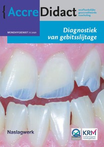 Diagnostiek van gebitsslijtage