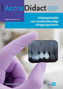 Interpretatie van tandheelkundige röntgenopnamen