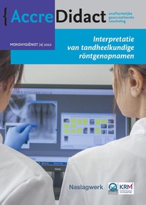 Interpretatie van tandheelkundige röntgenopnamen