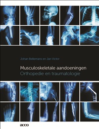 Musculoskeletale aandoeningen voorzijde