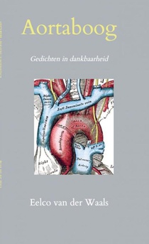 Aortaboog