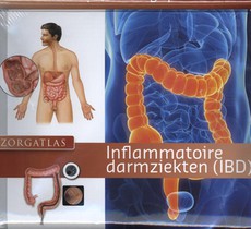 Inflammatoire darmziekten (IBD) voorzijde