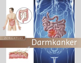 Zorgatlas Darmkanker voorzijde