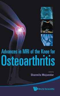 Advances In Mri Of The Knee For Osteoarthritis