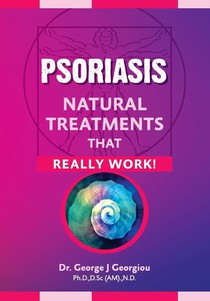 Psoriasis