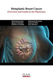 Metaplastic Breast Cancer: Overview and guide to the physicians