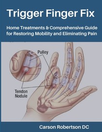 Trigger Finger Fix: Home Treatments & Comprehensive Guide for Restoring Mobility and Eliminating Pain