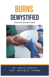 Burns Demystified