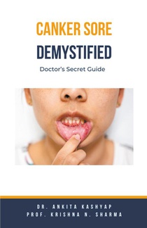 Canker Sore Demystified