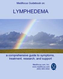 Medifocus Guidebook on: Lymphedema: A comprehensive guide to symptoms, treatment, research, and support