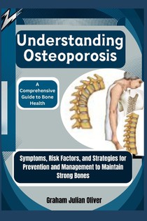 Understanding Osteoporosis: A Comprehensive Guide to Bone Health: Symptoms, Risk Factors, and Strategies for Prevention and Management to Maintain