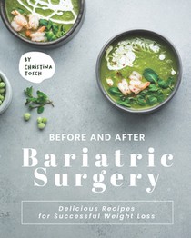 Before and After Bariatric Surgery