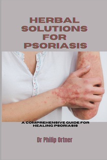 Herbal Solutions for Psoriasis: A Comprehensive Guide for healing psoriasis