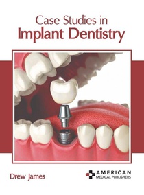 Case Studies in Implant Dentistry