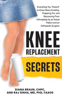Knee Replacement Secrets